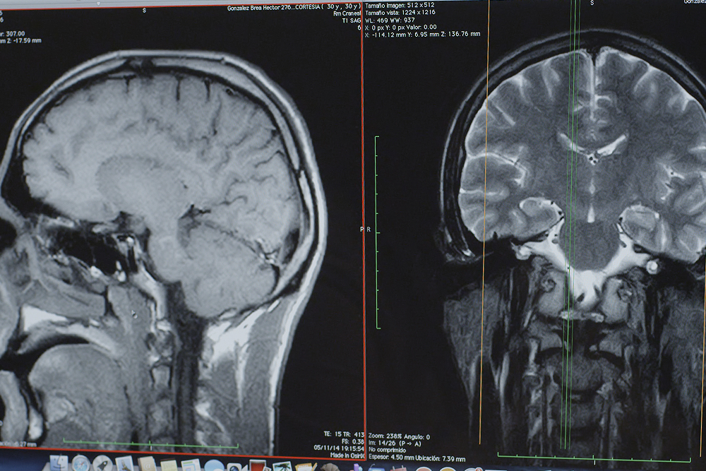 resonancia magentica